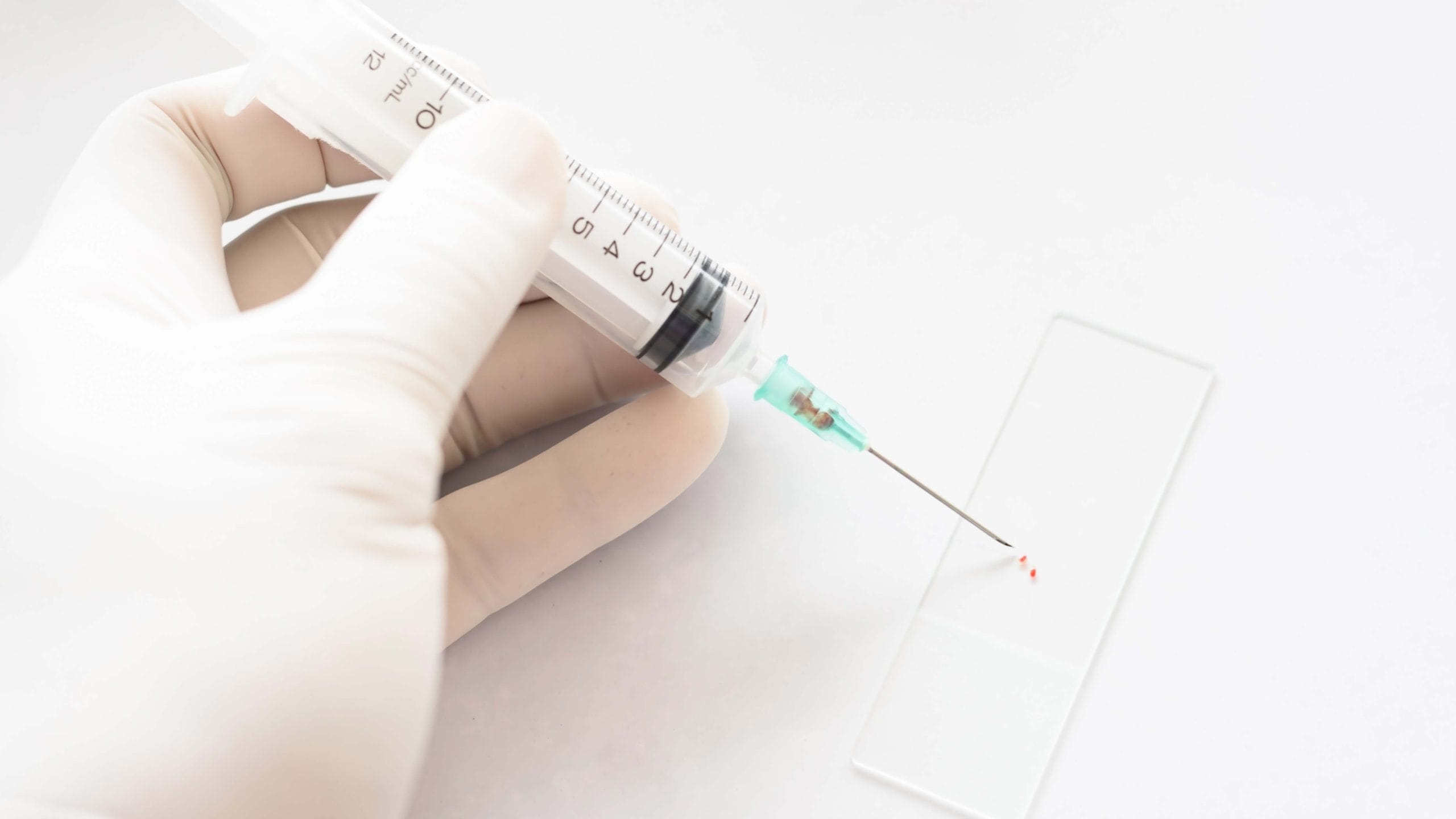 Perinöral enjeksiyon